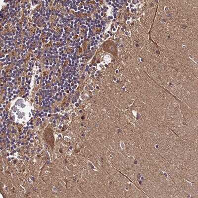 Immunohistochemistry-Paraffin: HLRC1 Antibody [NBP1-91994]