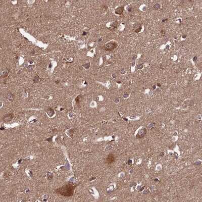 Immunohistochemistry-Paraffin: HLRC1 Antibody [NBP1-91994]