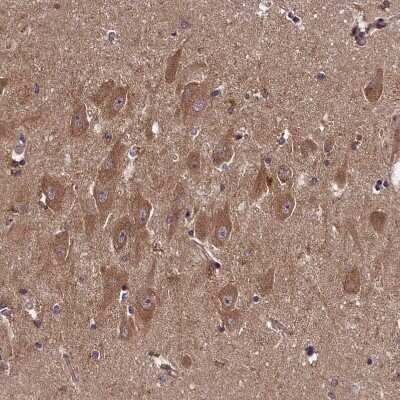 Immunohistochemistry-Paraffin: HLRC1 Antibody [NBP1-91994]
