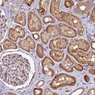 Immunohistochemistry-Paraffin: HLRC1 Antibody [NBP1-91994]