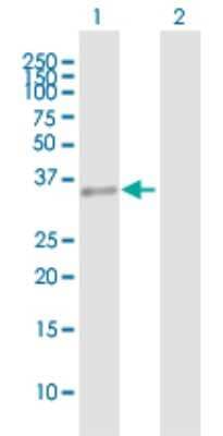 Western Blot: HLRC1 Antibody [H00083475-B01P]