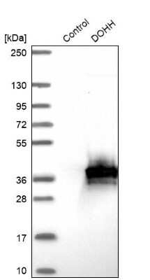 Western Blot: HLRC1 Antibody [NBP1-91994]