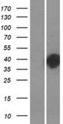 Western Blot: HLRC1 Overexpression Lysate [NBP2-06134]