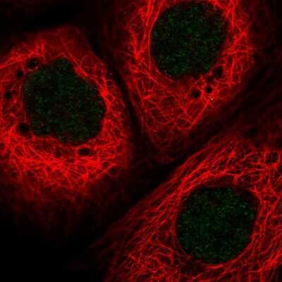 Immunocytochemistry/ Immunofluorescence: HLTF Antibody [NBP2-55017]