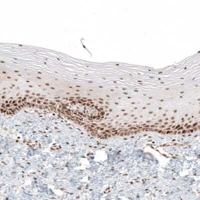 Immunohistochemistry-Paraffin: HLTF Antibody [NBP1-83256]