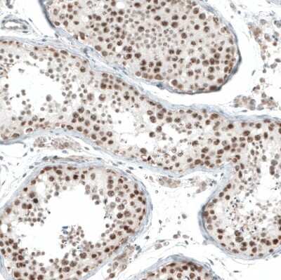 Immunohistochemistry-Paraffin: HLTF Antibody [NBP1-83256]