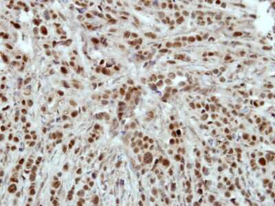 Immunohistochemistry-Paraffin: HLTF Antibody [NBP2-16857]