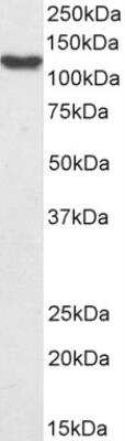 Western Blot: HLTF Antibody [NB100-1041]