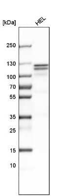 Western Blot: HLTF Antibody [NBP1-83256]