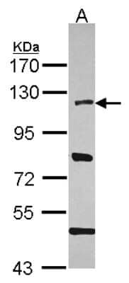 Western Blot: HLTF Antibody [NBP2-16857]