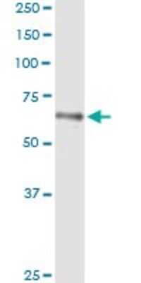 Western Blot: HLX1 Antibody (1B9) [H00003142-M05]
