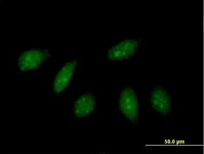 Immunocytochemistry/ Immunofluorescence: HLX1 Antibody [H00003142-B01P]