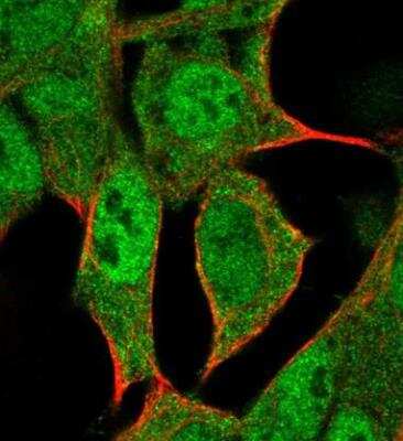 Immunocytochemistry/ Immunofluorescence: HLX1 Antibody [NBP1-89719]