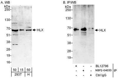 Immunoprecipitation: HLX1 Antibody [NBP2-04033]