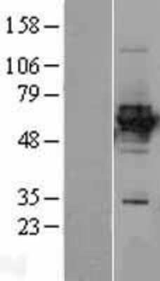 Western Blot: HLX1 Overexpression Lysate [NBL1-11601]