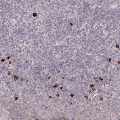 Immunohistochemistry-Paraffin: HM74A/PUMA-G/GPR109A/NIACR1 Antibody [NBP1-92180]