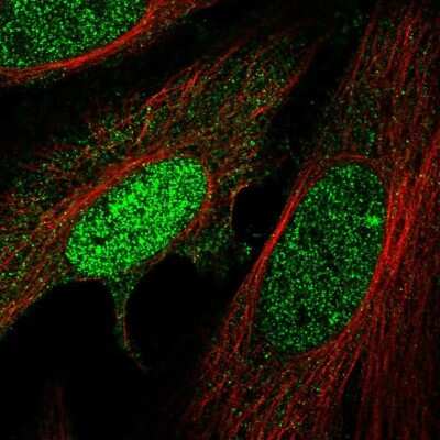 Immunocytochemistry/ Immunofluorescence: HMBOX1 Antibody [NBP2-32392]