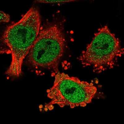 Immunocytochemistry/ Immunofluorescence: HMBOX1 Antibody [NBP2-58377]