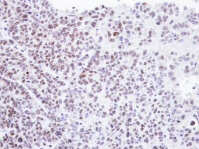 Immunohistochemistry-Paraffin: HMBOX1 Antibody [NBP1-31316]