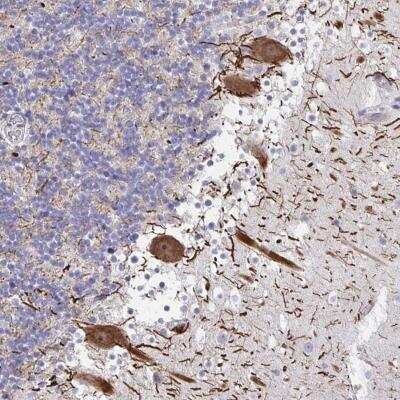 Immunohistochemistry-Paraffin: HMBOX1 Antibody [NBP2-32392]