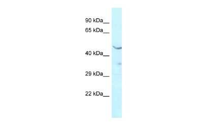 Western Blot: HMBOX1 Antibody [NBP2-87577]