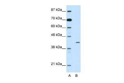 Western Blot: HMBOX1 Antibody [NBP2-87578]