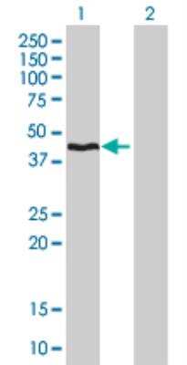 Western Blot: HMBS Antibody (3E8) [H00003145-M01]