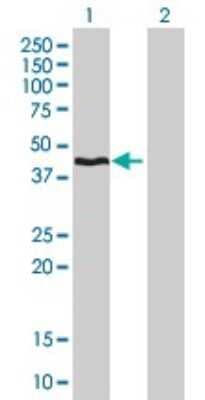 Western Blot: HMBS Antibody (3E8) [H00003145-M01]