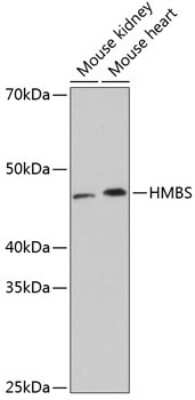 Western Blot: HMBS Antibody (9T8Z9) [NBP3-15407]