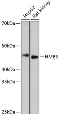 Western Blot: HMBS Antibody (9T8Z9) [NBP3-15407]