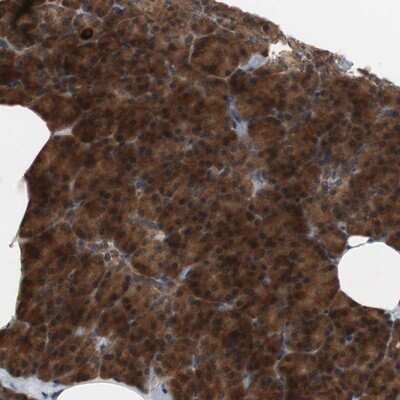 Immunohistochemistry-Paraffin: HMBS Antibody [NBP1-87329]