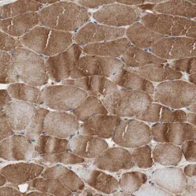 Immunohistochemistry-Paraffin: HMBS Antibody [NBP1-87329]