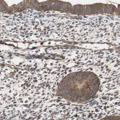 Immunohistochemistry-Paraffin: HMBS Antibody [NBP1-87329]