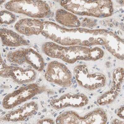 Immunohistochemistry-Paraffin: HMBS Antibody [NBP1-87329]
