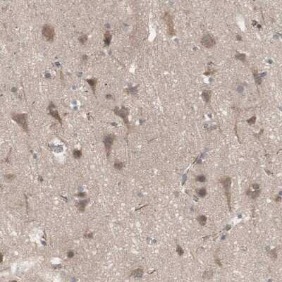 Immunohistochemistry-Paraffin: HMBS Antibody [NBP1-87329]