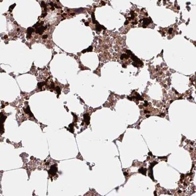 Immunohistochemistry-Paraffin: HMBS Antibody [NBP2-33600]