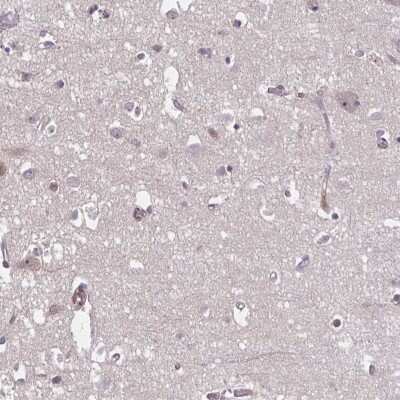Immunohistochemistry-Paraffin: HMBS Antibody [NBP2-33600]