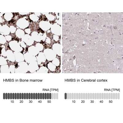 Immunohistochemistry-Paraffin: HMBS Antibody [NBP2-33600]