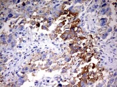 Immunohistochemistry: HMBS Antibody (OTI3F4) - Azide and BSA Free [NBP2-70894]
