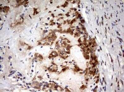 Immunohistochemistry: HMBS Antibody (OTI3F4) - Azide and BSA Free [NBP2-70894]