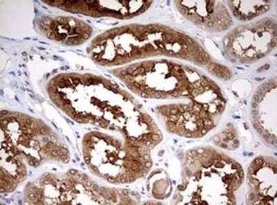 Immunohistochemistry: HMBS Antibody (OTI3F4) - Azide and BSA Free [NBP2-70894]