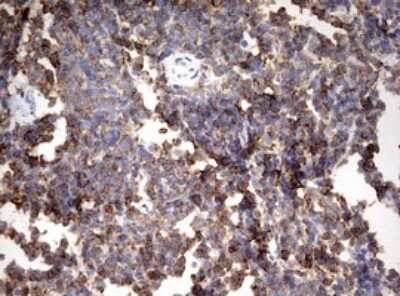 Immunohistochemistry: HMBS Antibody (OTI3F4) - Azide and BSA Free [NBP2-70894]
