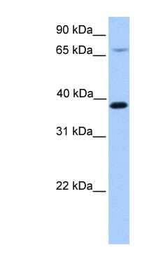 Western Blot: HMBS Antibody [NBP1-56412]