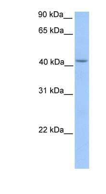 Western Blot: HMBS Antibody [NBP1-56627]