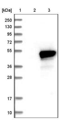 Western Blot: HMBS Antibody [NBP1-87329]