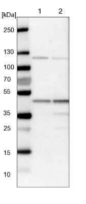 Western Blot: HMBS Antibody [NBP1-87329]