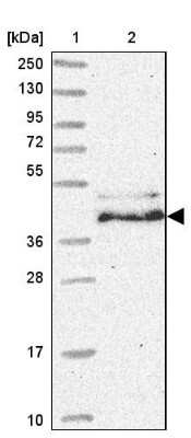 Western Blot: HMBS Antibody [NBP2-33600]