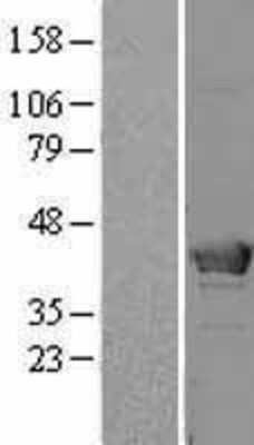 Western Blot: HMBS Overexpression Lysate [NBL1-11604]