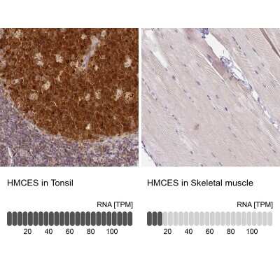 Immunohistochemistry-Paraffin: HMCES Antibody [NBP2-14410]