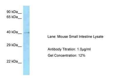 Western Blot: HMCES Antibody [NBP2-87580]